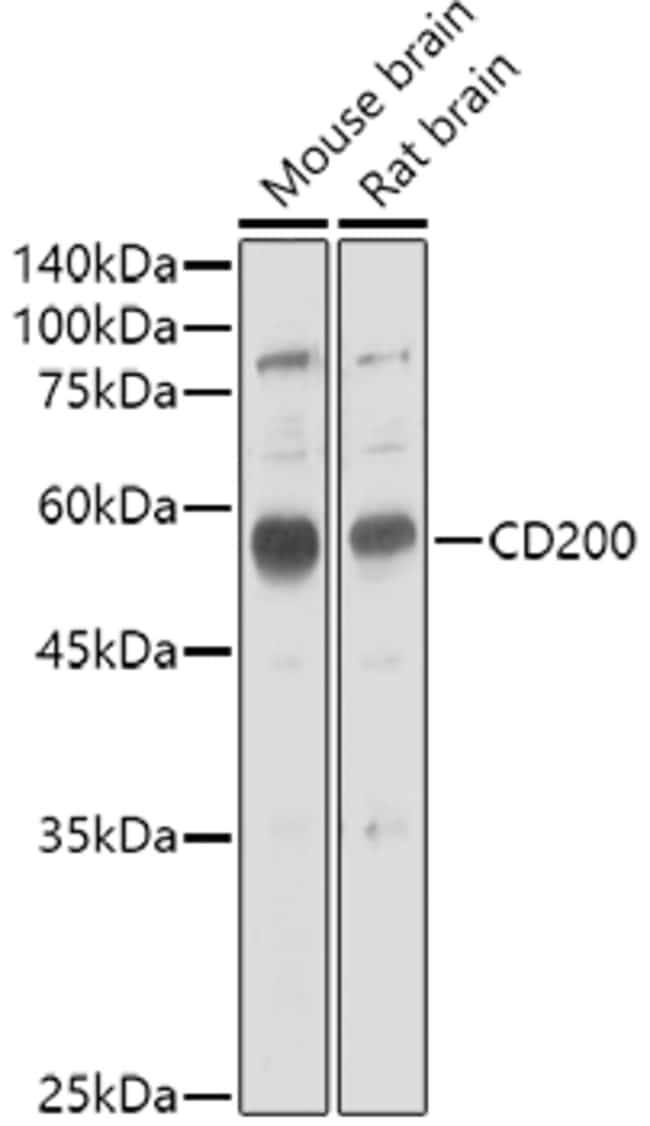 100UL CD200 ANTIBODY 100 ul