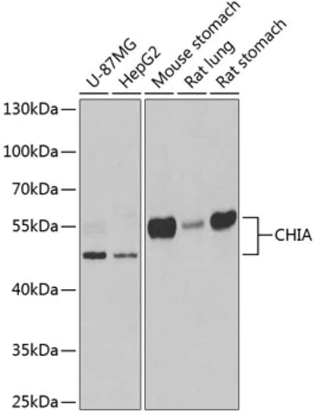 100UL CHIA ANTIBODY 100 ul