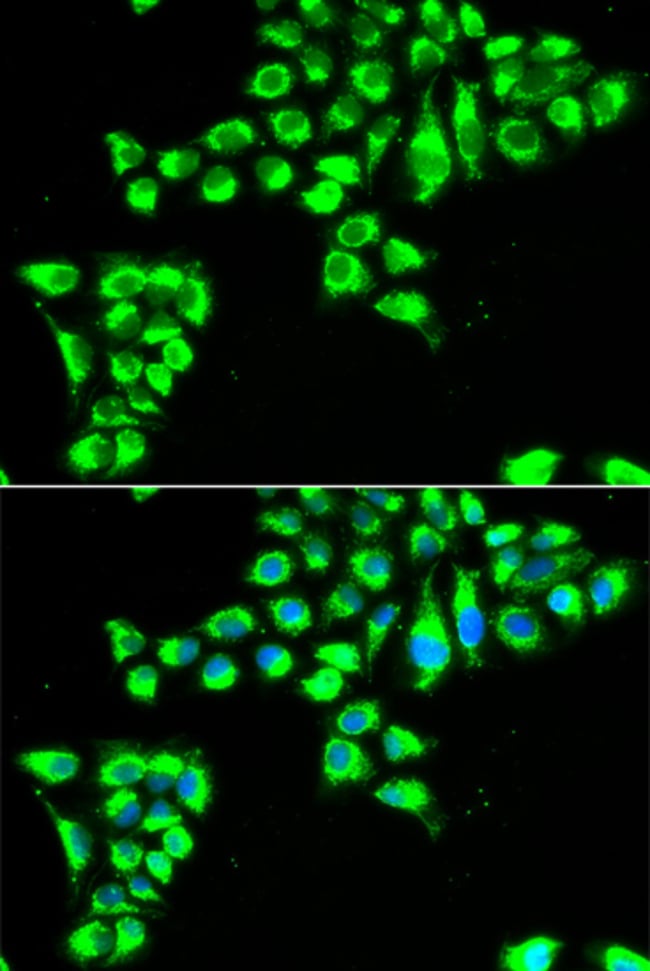 100UL CLAUDIN 2 ANTIBODY 100 ul