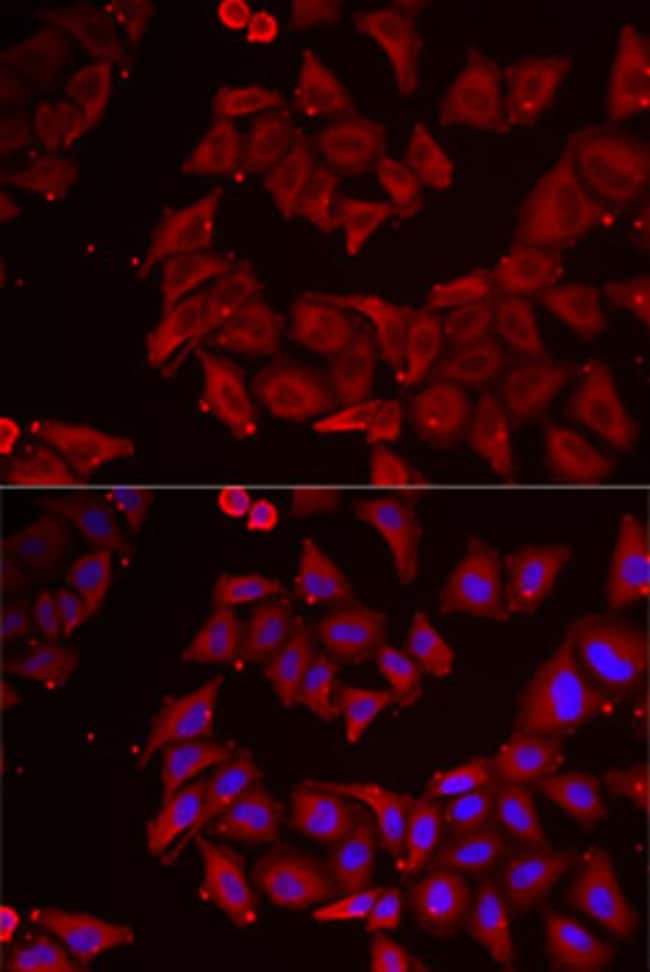 100UL CMPK1 ANTIBODY 100 ul