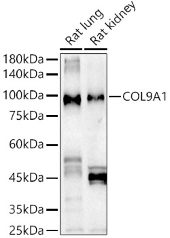 100UL COL9A1 ANTIBODY 100 ul
