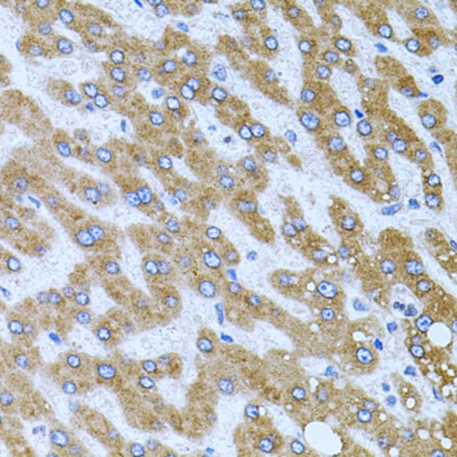 100UL CARBOXYPEPTIDASE M ANTIBODY 100 ul