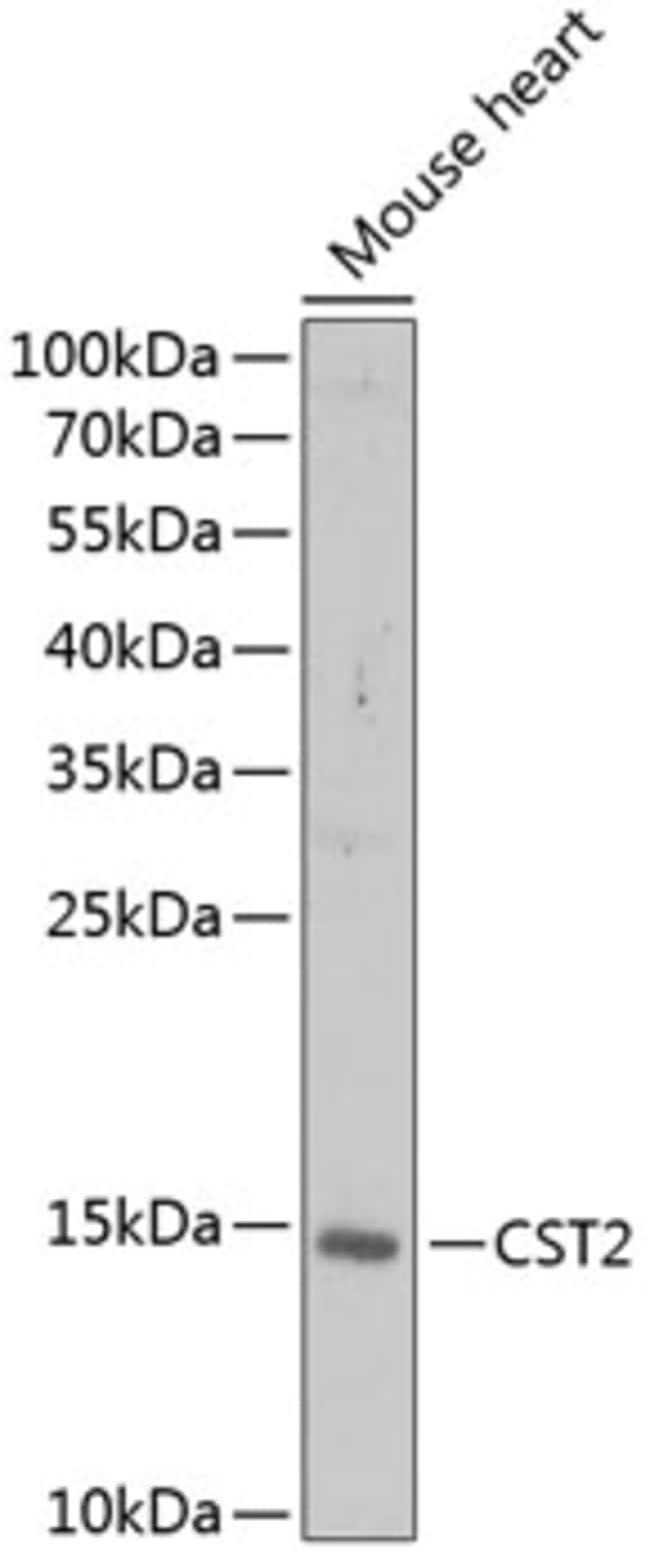 100UL CYSTATIN 2 ANTIBODY 100 ul