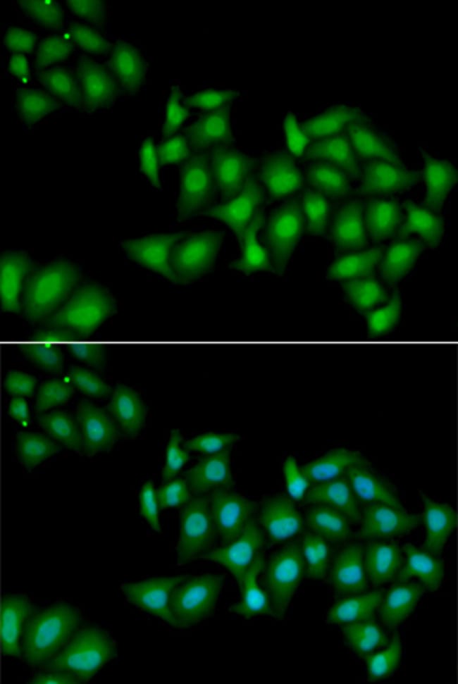 100UL DDX1 ANTIBODY 100 ul