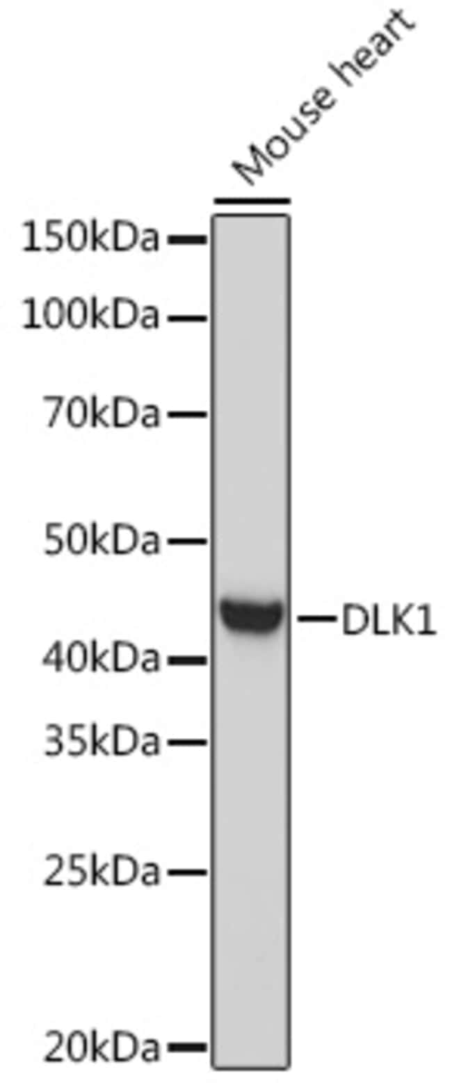 100UL DLK1 ANTIBODY 100 ul