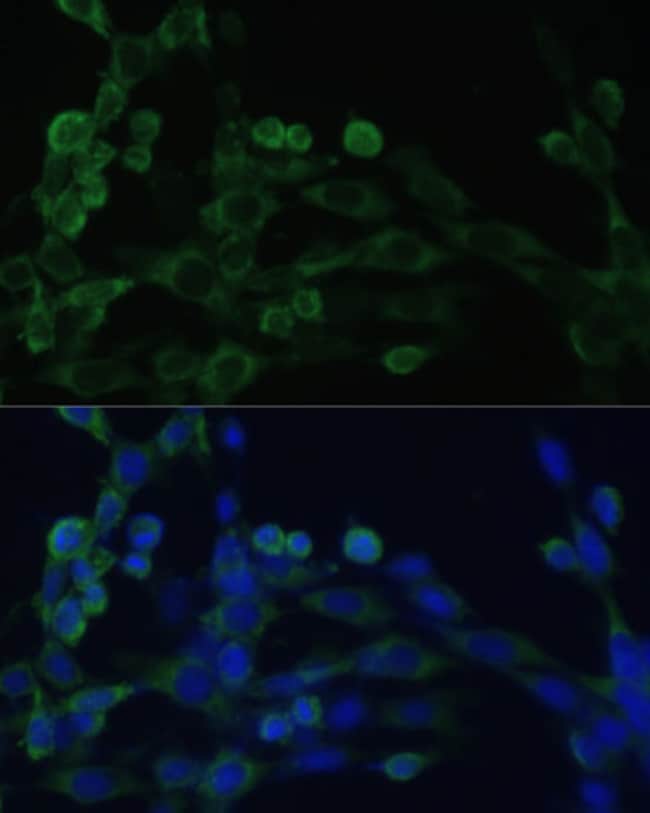 100UL EEF1B2 ANTIBODY 100 ul