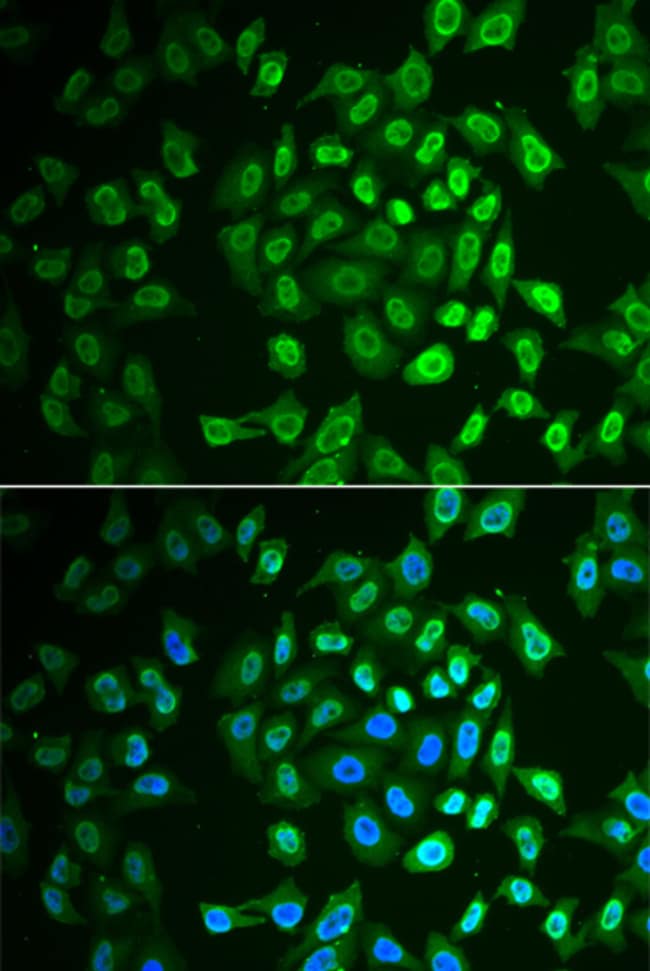 100UL FAH ANTIBODY 100 ul