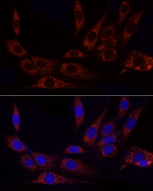 100UL GLUD2 ANTIBODY 100 ul