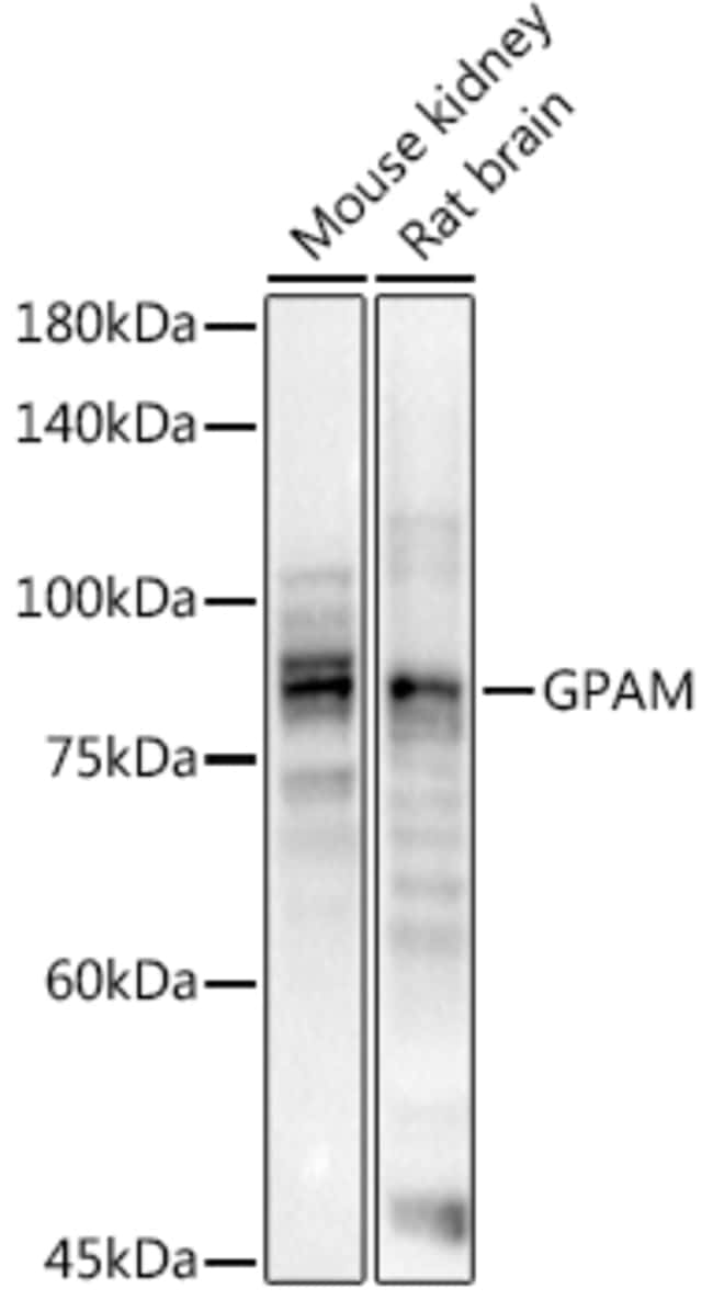 100UL GPAM ANTIBODY 100 ul
