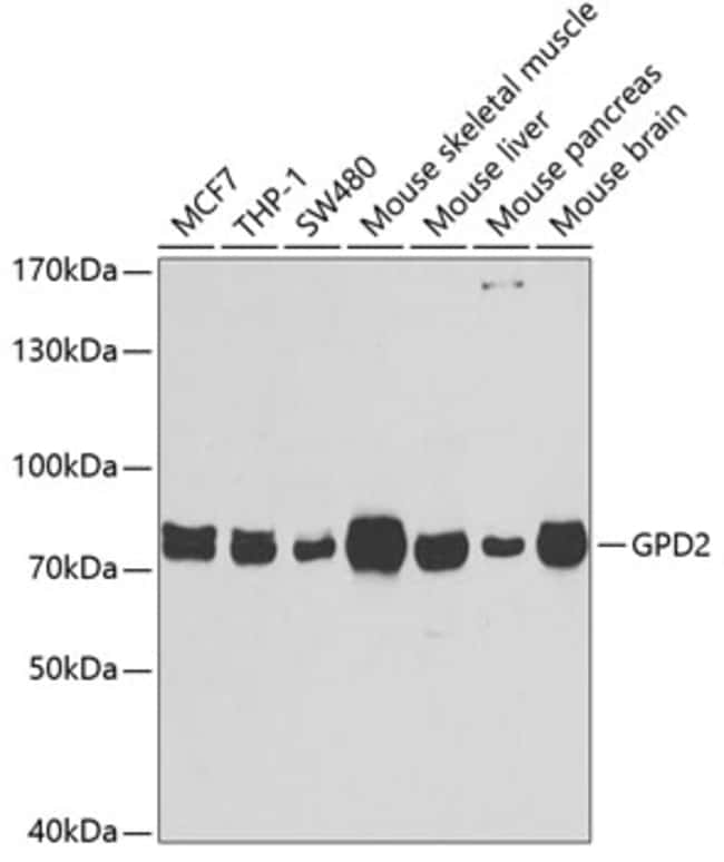 100UL GPD2 ANTIBODY 100 ul
