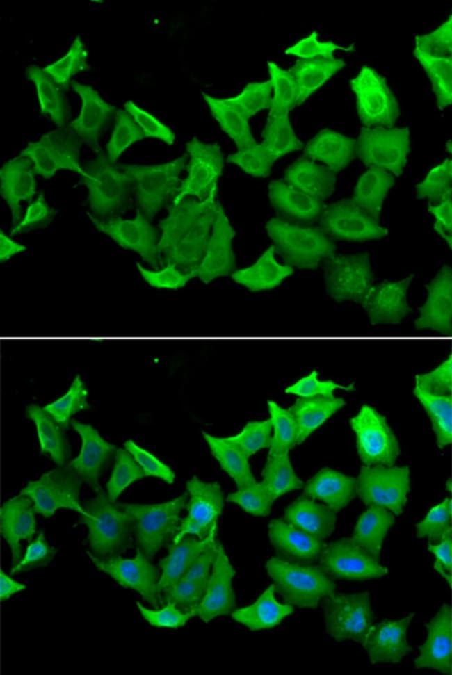 100UL HAGH ANTIBODY 100 ul