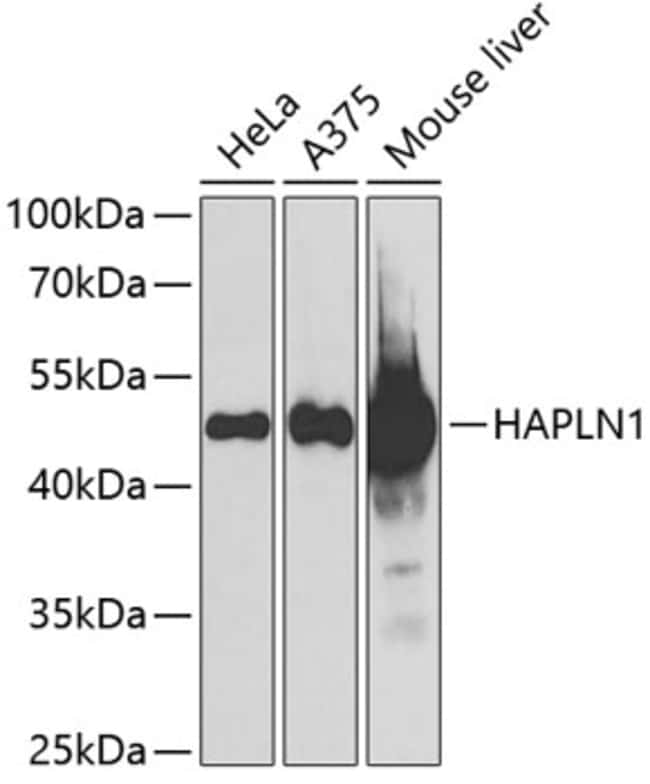 100UL HAPLN1 ANTIBODY 100 ul