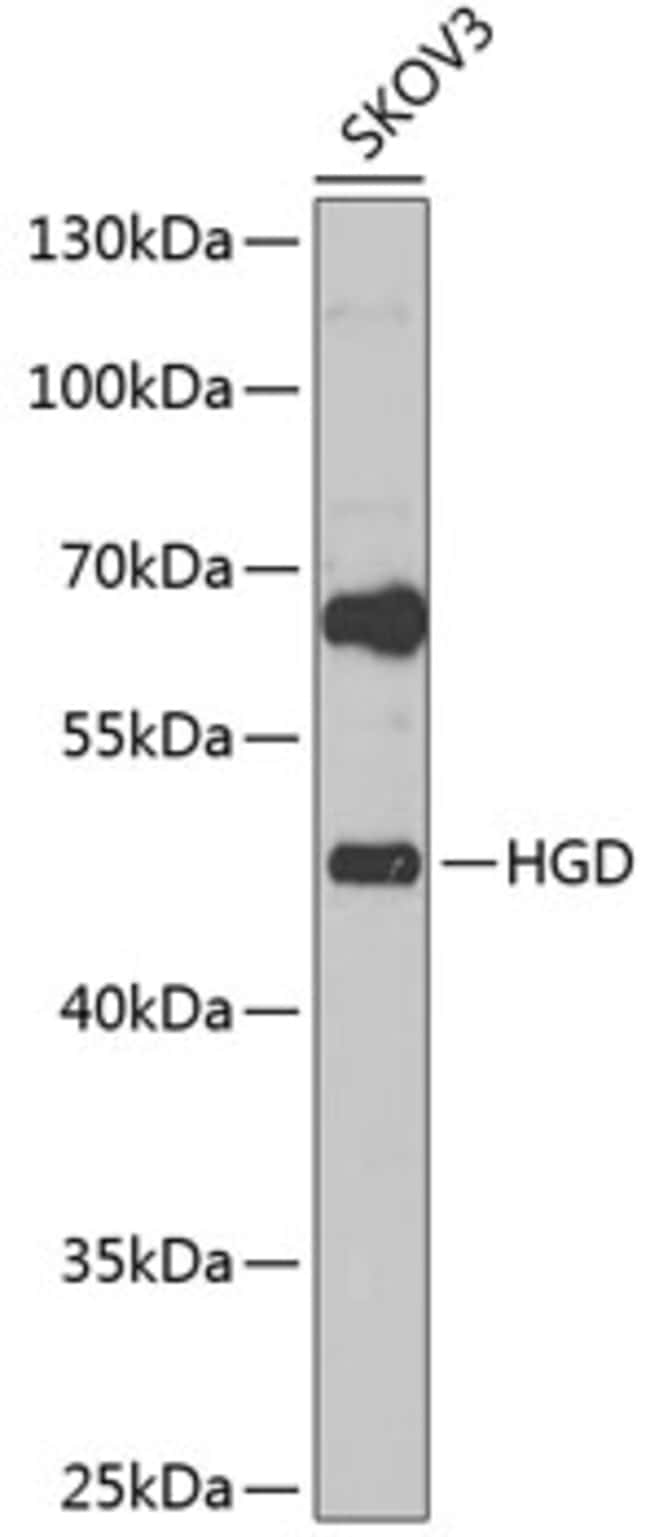 100UL HGD ANTIBODY 100 ul