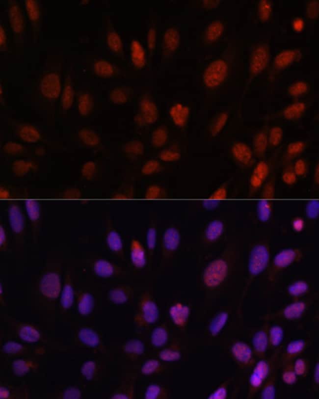100UL HOXB1 ANTIBODY 100 ul