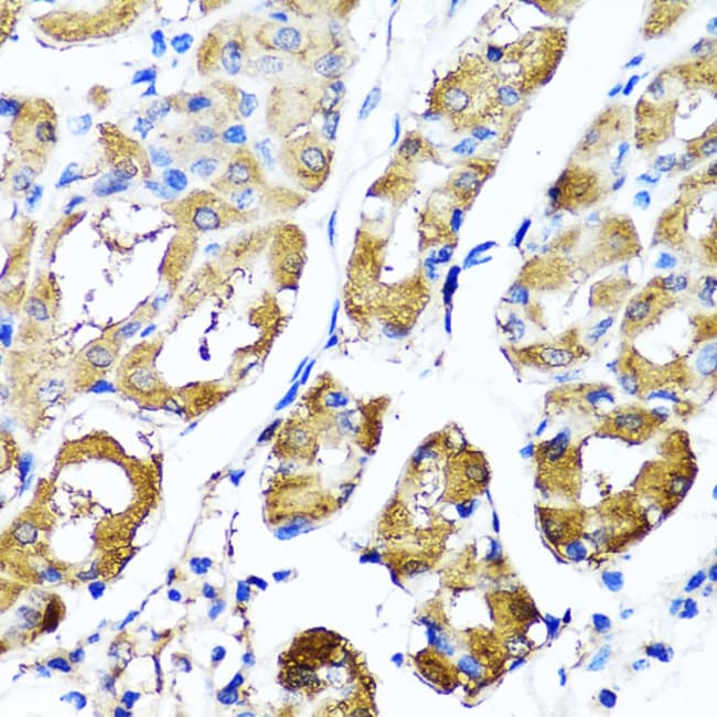 100UL HYAL1 ANTIBODY 100 ul