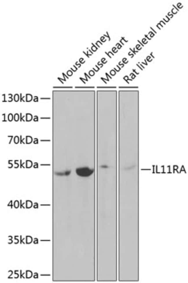 100UL IL11RA ANTIBODY 100 ul