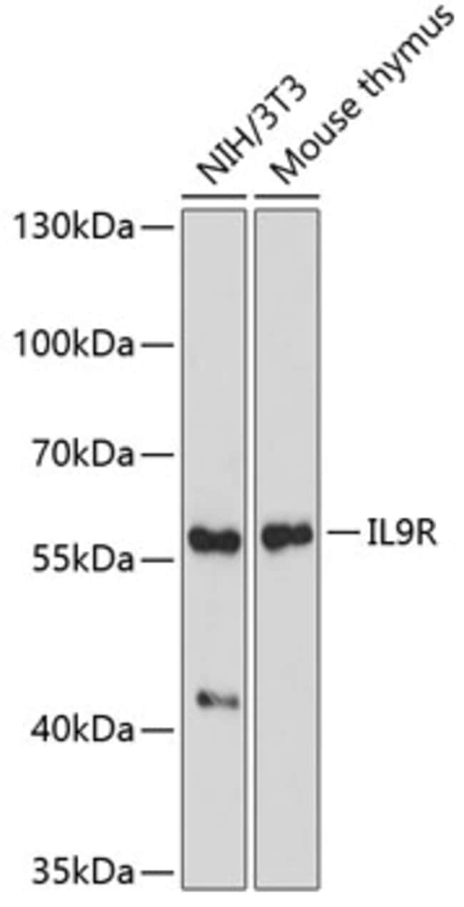 100UL IL9R ANTIBODY 100 ul