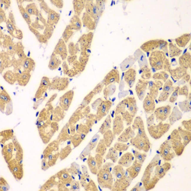 100UL KYNU ANTIBODY 100 ul