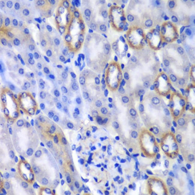 100UL MATK ANTIBODY 100 ul