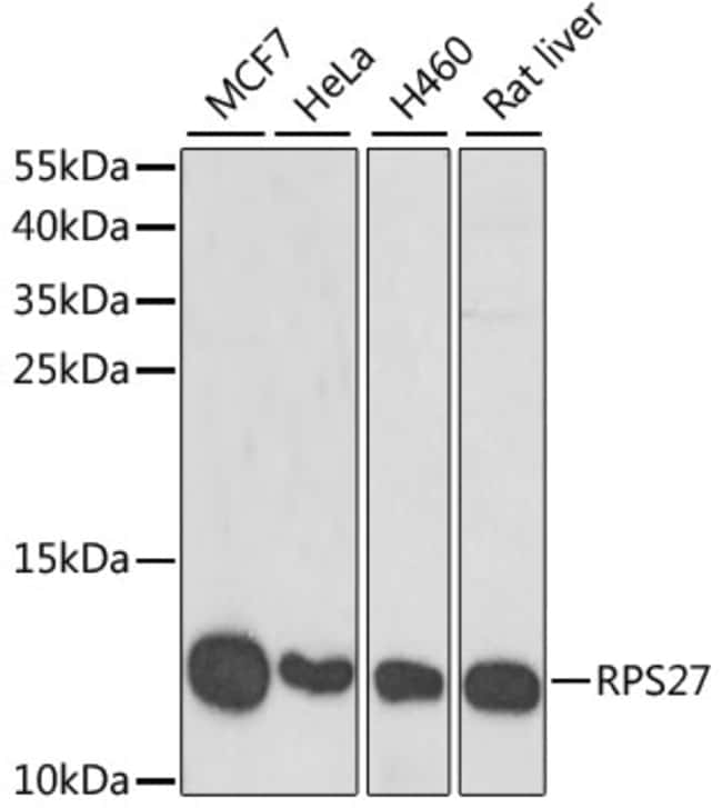 100UL MPS1 ANTIBODY 100 ul