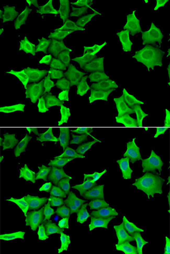 100UL HAI-2 ANTIBODY 100 ul