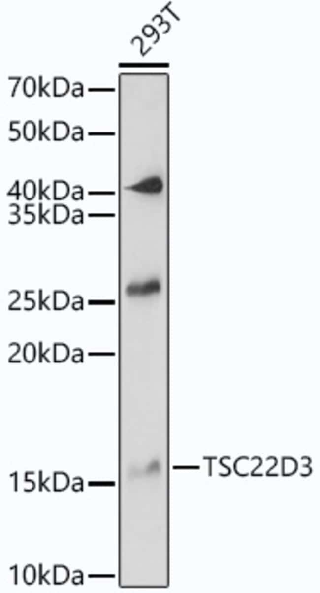 100UL GILZ ANTIBODY 100 ul