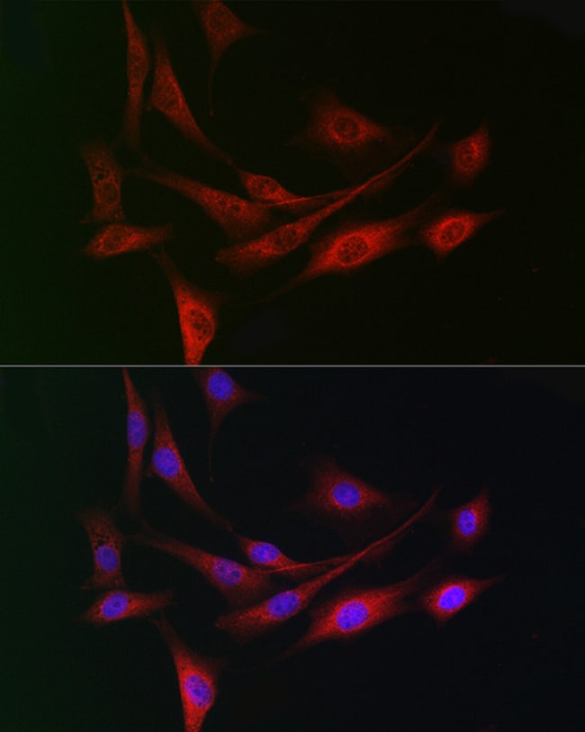 100UL DCAF7 ANTIBODY 100 ul