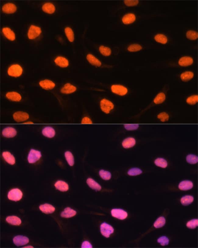 100UL DREF ANTIBODY 100 ul