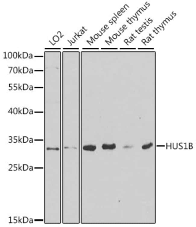 100UL HUS1B ANTIBODY 100 ul
