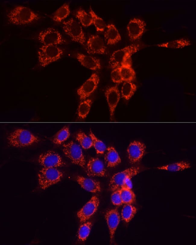 100UL ACSL4 ANTIBODY 100 ul