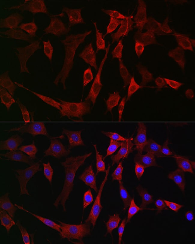 100UL ALOX15B ANTIBODY 100 ul