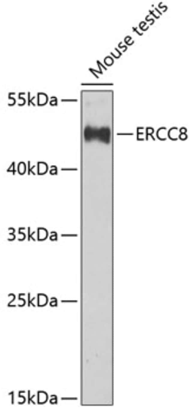 100UL ERCC8 ANTIBODY 100 ul