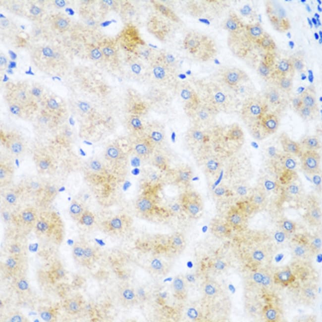 100UL DHODH ANTIBODY 100 ul