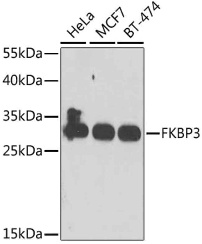 100UL FKBP25 ANTIBODY 100 ul