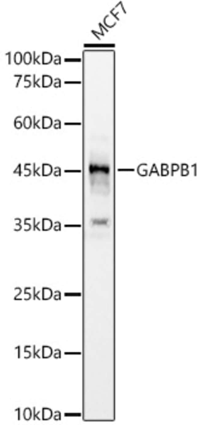 100UL GABPB1 ANTIBODY 100 ul