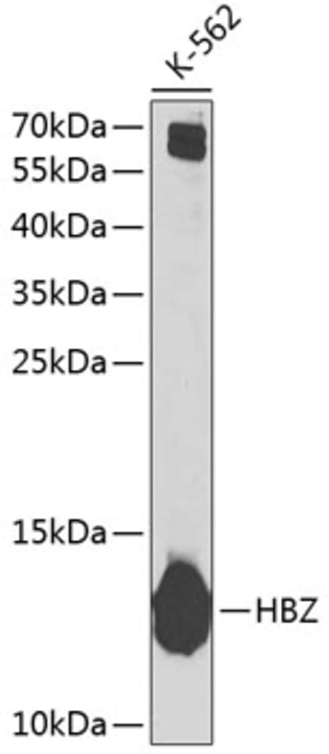 100UL HBZ ANTIBODY 100 ul