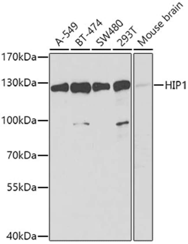 100UL HIP1 ANTIBODY 100 ul