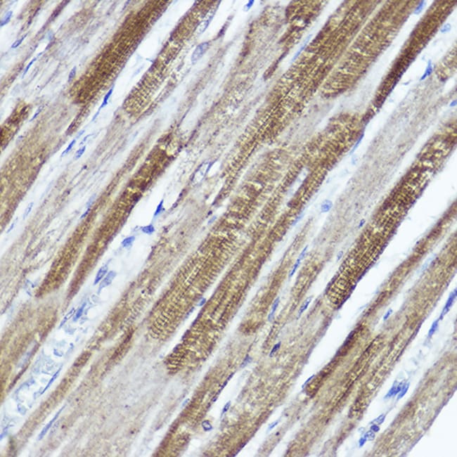 100UL KV4.3 (KCND3) ANTIBODY 100 ul