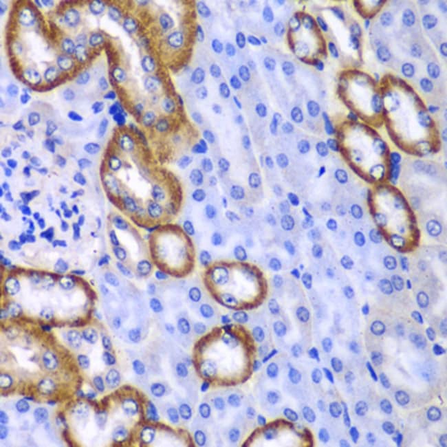 100UL MYO1C ANTIBODY 100 ul