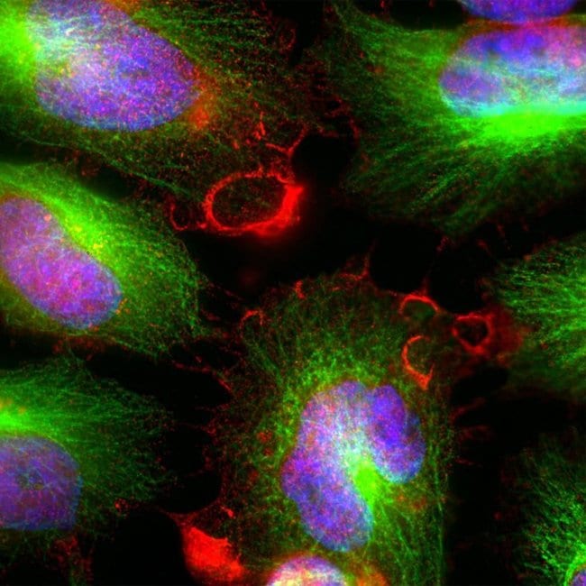 100UL MARCKS ANTIBODY 100 ul