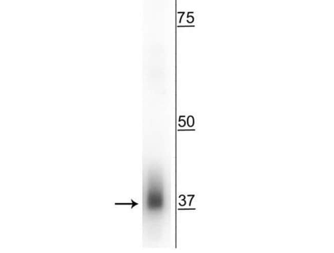 100UL C2ORF33 ANTIBODY 100 ul