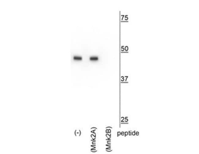 100UL MKNK2B ANTIBODY 100 ul