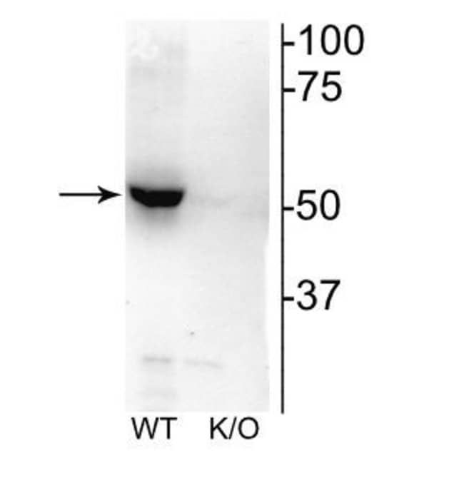100UL CHRNB2 ANTIBODY 100 ul
