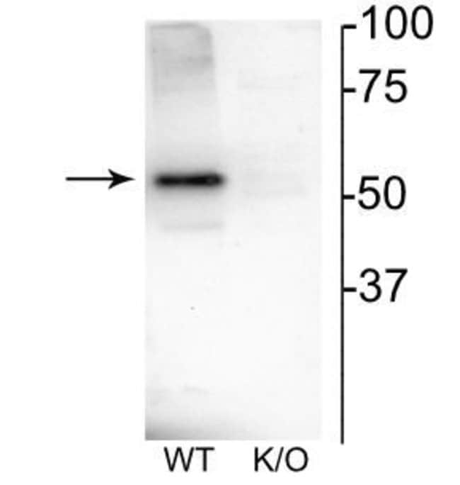 100UL CHRNB4 ANTIBODY 100 ul