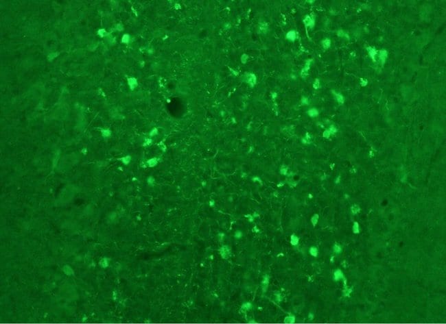 100UL CALRETININ ANTIBODY 100 ul