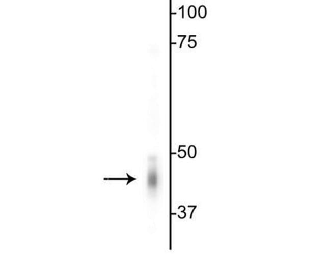 100UL GABRG2 ANTIBODY 100 ul
