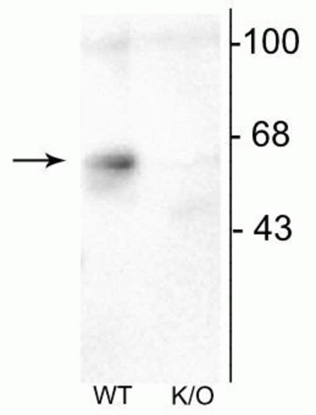 100UL GABRA6 ANTIBODY 100 ul