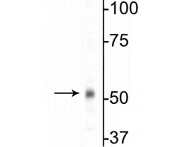100UL GABRB1 ANTIBODY 100 ul