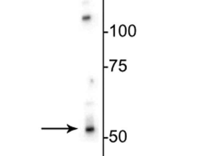 100UL GABRB3 ANTIBODY 100 ul