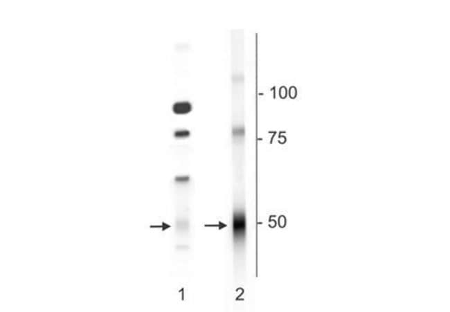 100UL GABRD ANTIBODY 100 ul
